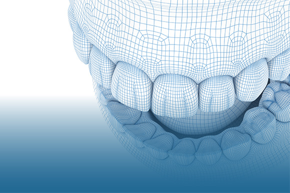 Focus Dental Bodrum CAD/CAM Focus Dental Bodrum CAD/CAM