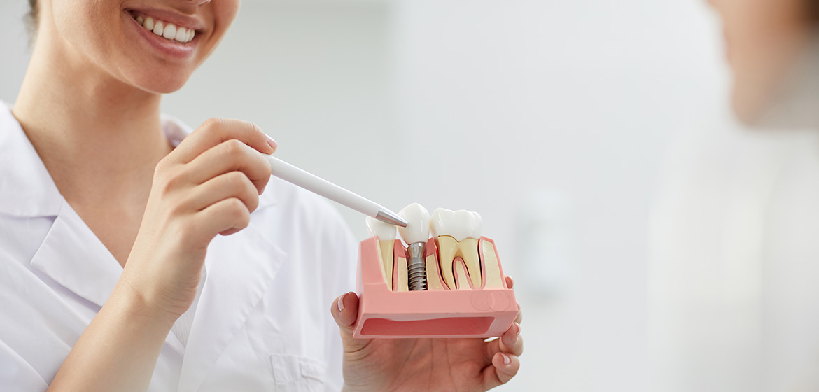 Conditions for Implants