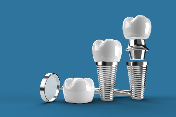 Focus Dental Clinic İmplant Diş Tedavileri Focus Dental Clinic İmplant Diş Tedavileri